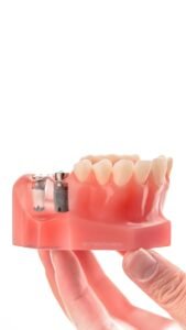 curso de fotografía clínica dental