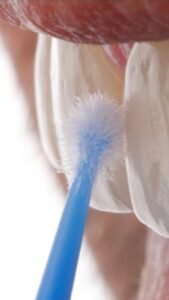 fotografía Dental curso