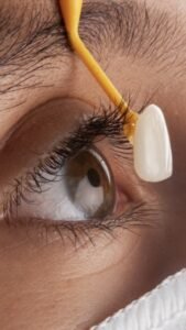 fotografía dental profesional