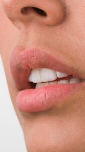 fotografía extraoral